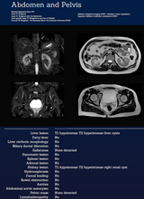 Load image into Gallery viewer, Whole Body MRI