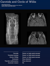 Load image into Gallery viewer, Whole Body MRI