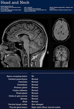 Load image into Gallery viewer, Whole Body MRI