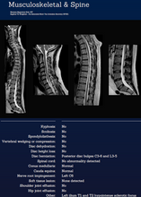 Load image into Gallery viewer, Whole Body MRI