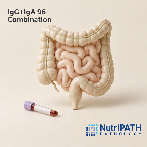 IgG+IgA 96 Combination — original OptiLabs clinical illustration with supplier logo; collection items are illustrative, not the exact supplied kit