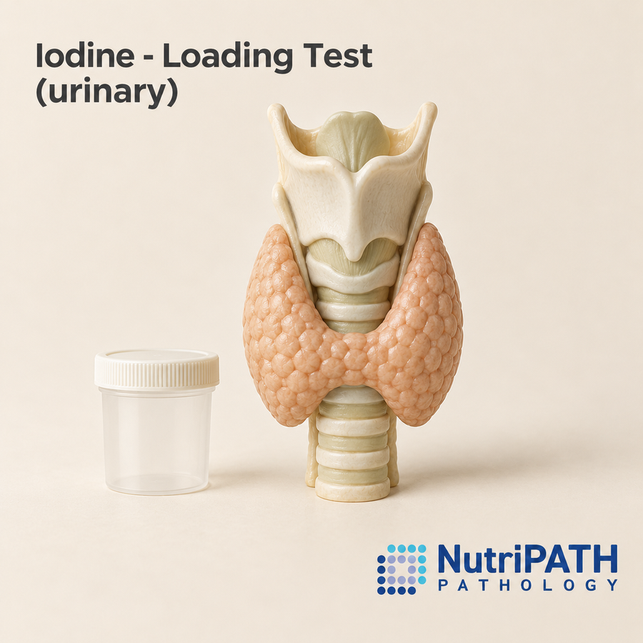 Iodine - Loading Test (urinary) — original OptiLabs clinical illustration with supplier logo; collection items are illustrative, not the exact supplied kit
