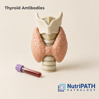 Thyroid Antibodies — original OptiLabs clinical illustration with supplier logo; collection items are illustrative, not the exact supplied kit