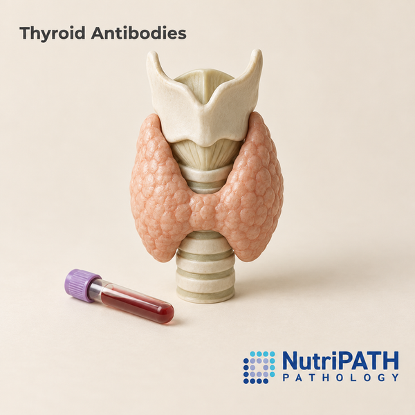 Thyroid Antibodies — original OptiLabs clinical illustration with supplier logo; collection items are illustrative, not the exact supplied kit