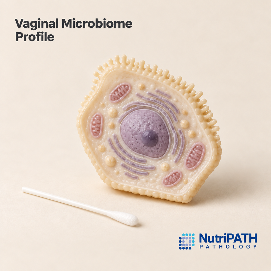 Vaginal Microbiome Profile — original OptiLabs clinical illustration with supplier logo; collection items are illustrative, not the exact supplied kit