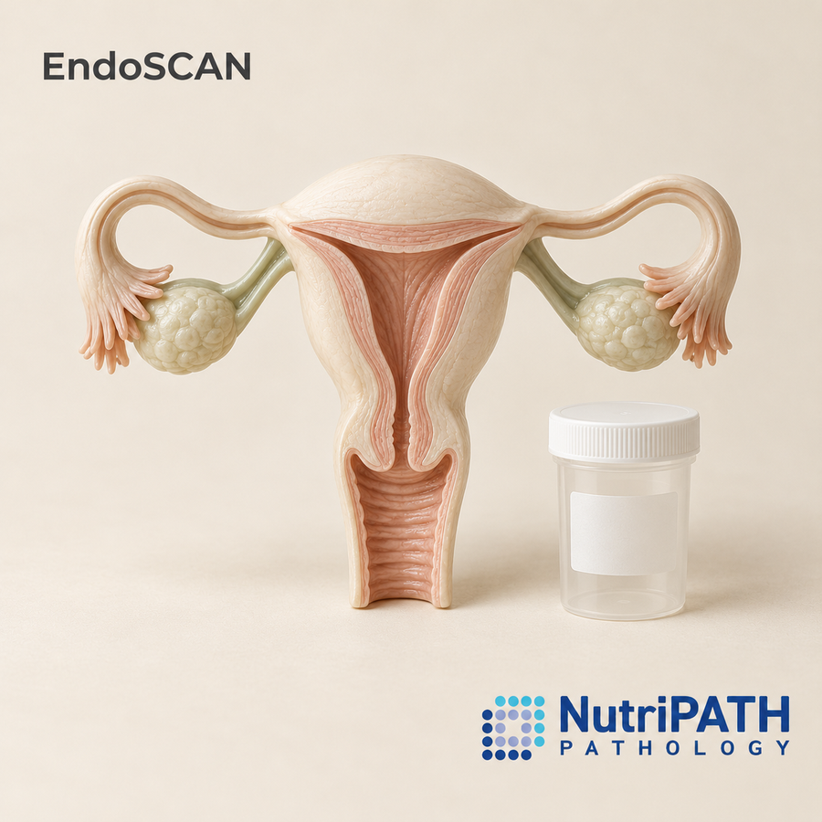 EndoSCAN — original OptiLabs clinical illustration with supplier logo; collection items are illustrative, not the exact supplied kit