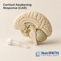 Cortisol Awakening Response (CAR) — original OptiLabs clinical illustration with supplier logo; collection items are illustrative, not the exact supplied kit