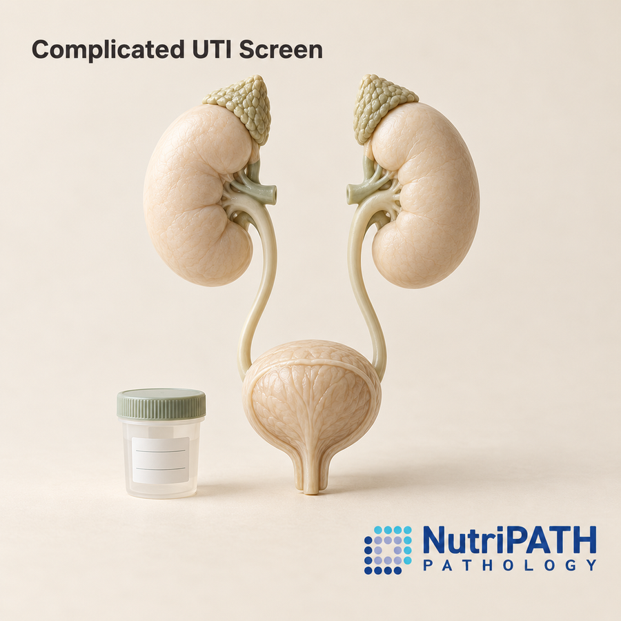 Complicated UTI Screen — original OptiLabs clinical illustration with supplier logo; collection items are illustrative, not the exact supplied kit