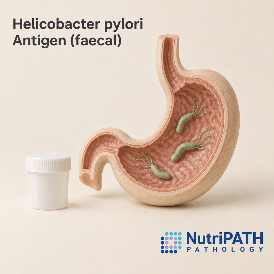 Helicobacter pylori Antigen (faecal) — original OptiLabs clinical illustration with supplier logo; collection items are illustrative, not the exact supplied kit