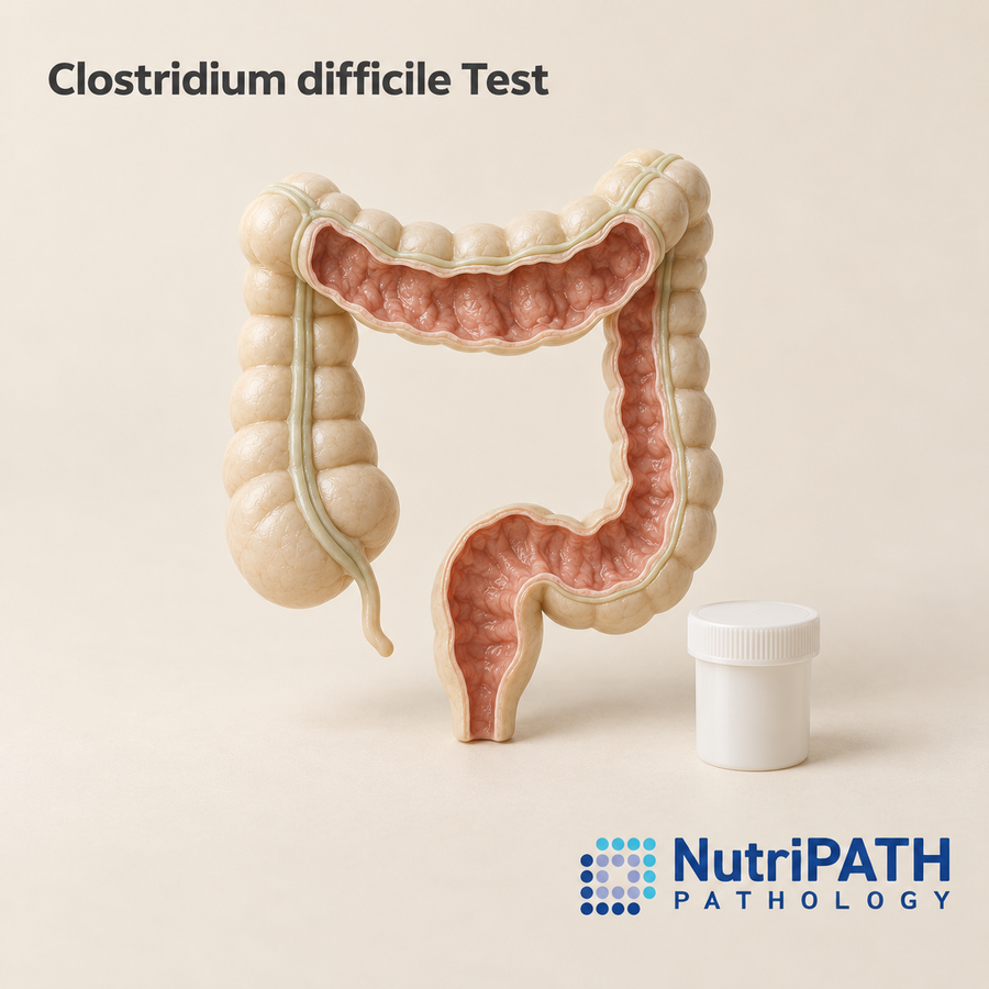 Clostridium difficile Test — original OptiLabs clinical illustration with supplier logo; collection items are illustrative, not the exact supplied kit