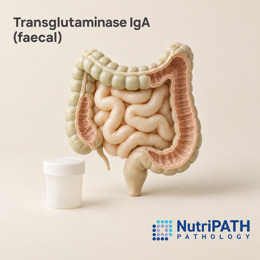 Transglutaminase IgA (faecal) — original OptiLabs clinical illustration with supplier logo; collection items are illustrative, not the exact supplied kit