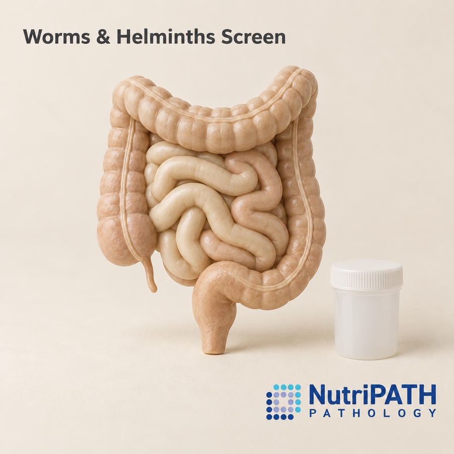 Worms & Helminths Screen — original OptiLabs clinical illustration with supplier logo; collection items are illustrative, not the exact supplied kit