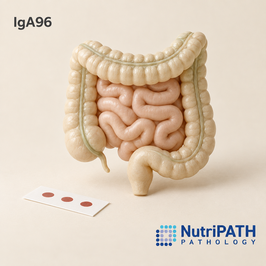 IgA96 — original OptiLabs clinical illustration with supplier logo; collection items are illustrative, not the exact supplied kit