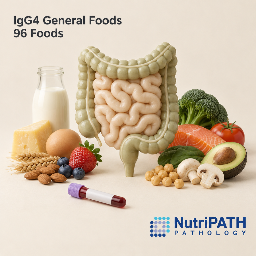 IgG4 General Foods 96 Foods — original OptiLabs clinical illustration with supplier logo; collection items are illustrative, not the exact supplied kit
