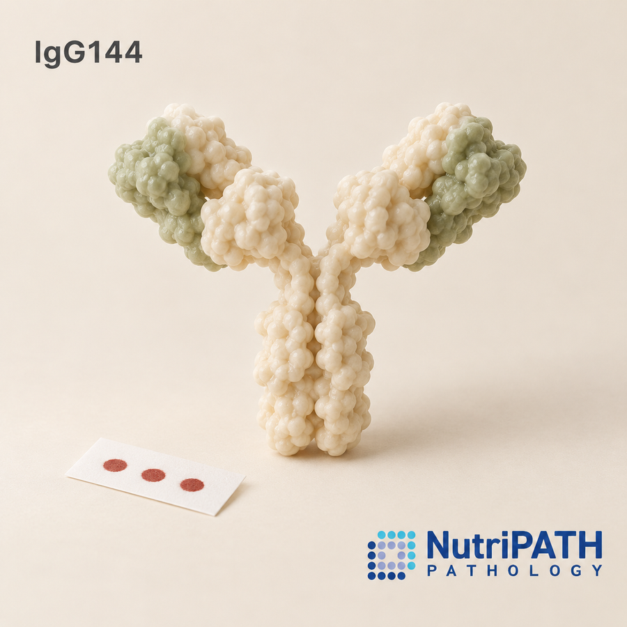 IgG144 — original OptiLabs clinical illustration with supplier logo; collection items are illustrative, not the exact supplied kit