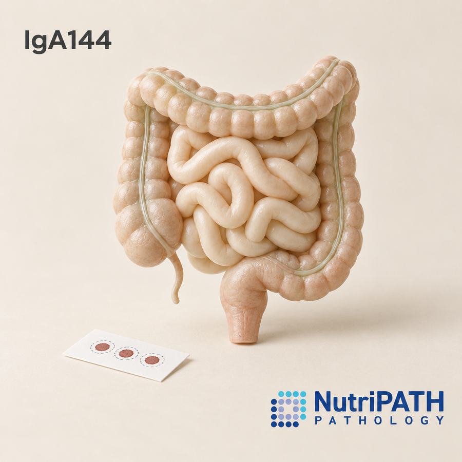 IgA144 — original OptiLabs clinical illustration with supplier logo; collection items are illustrative, not the exact supplied kit