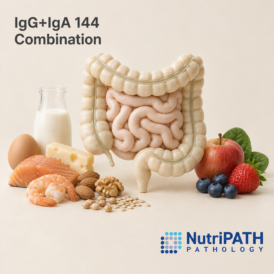 IgG+IgA 144 Combination — original OptiLabs clinical illustration with supplier logo; collection items are illustrative, not the exact supplied kit