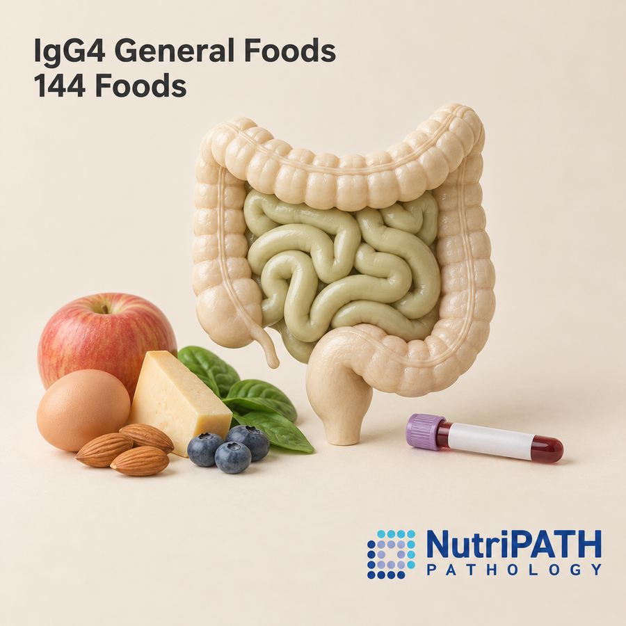 IgG4 General Foods 144 Foods — original OptiLabs clinical illustration with supplier logo; collection items are illustrative, not the exact supplied kit