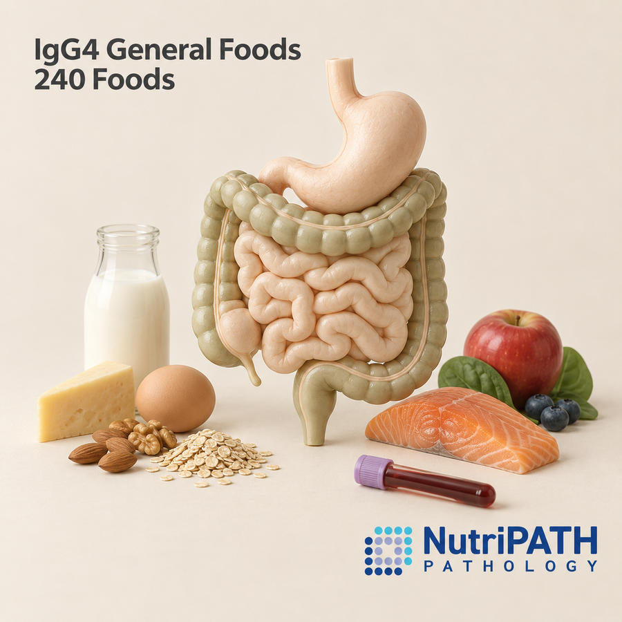 IgG4 General Foods 240 Foods — original OptiLabs clinical illustration with supplier logo; collection items are illustrative, not the exact supplied kit