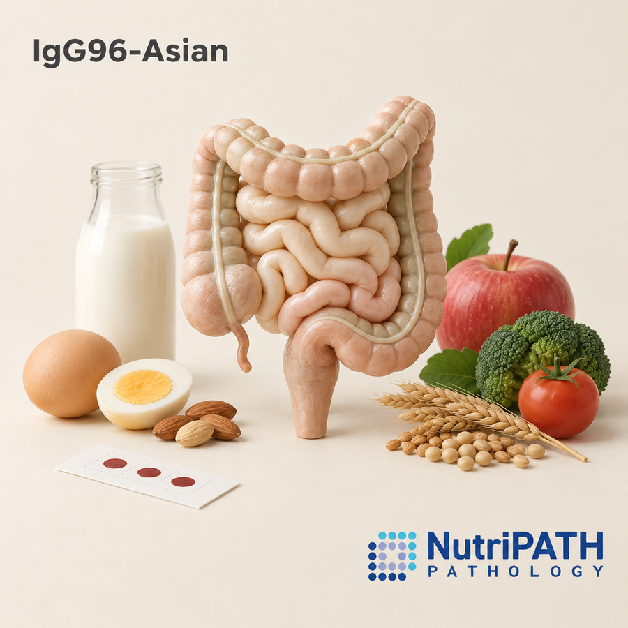 IgG96-Asian — original OptiLabs clinical illustration with supplier logo; collection items are illustrative, not the exact supplied kit