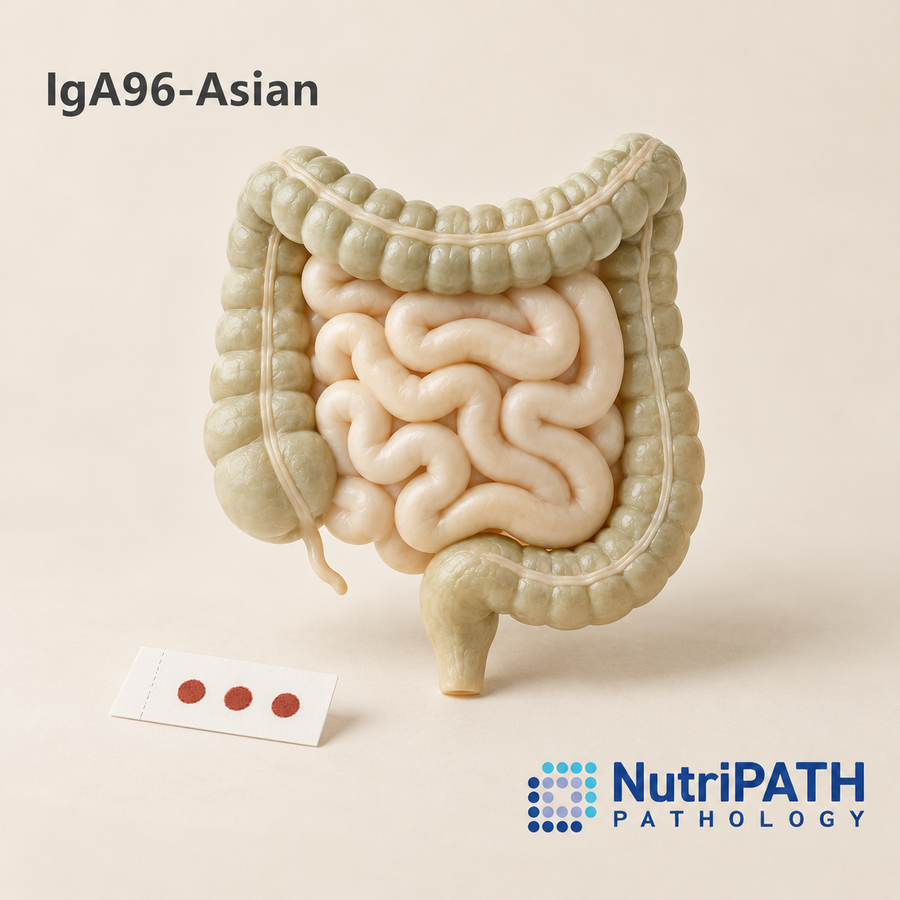 IgA96-Asian — original OptiLabs clinical illustration with supplier logo; collection items are illustrative, not the exact supplied kit