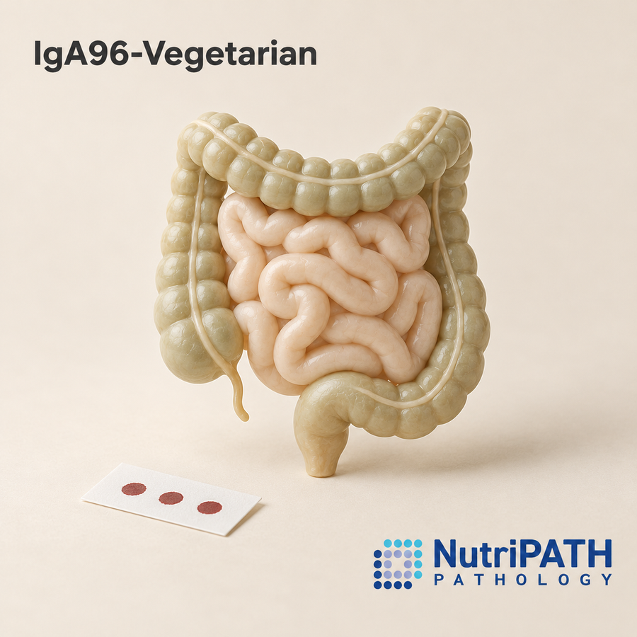 IgA96-Vegetarian — original OptiLabs clinical illustration with supplier logo; collection items are illustrative, not the exact supplied kit
