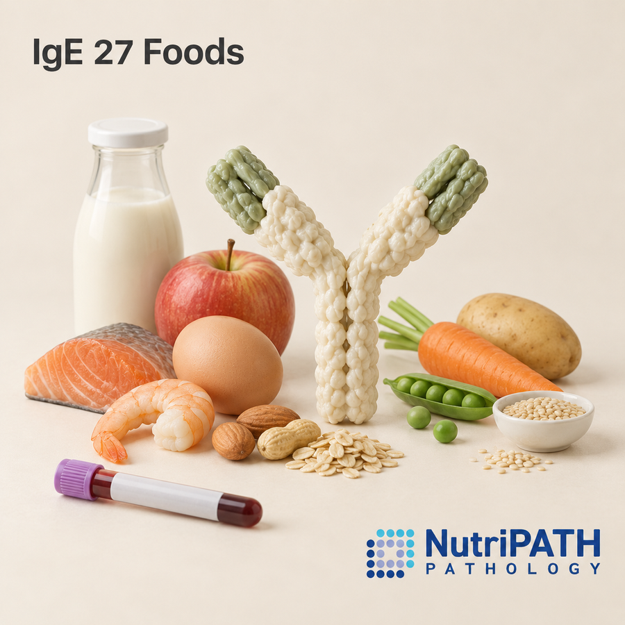 IgE 27 Foods — original OptiLabs clinical illustration with supplier logo; collection items are illustrative, not the exact supplied kit
