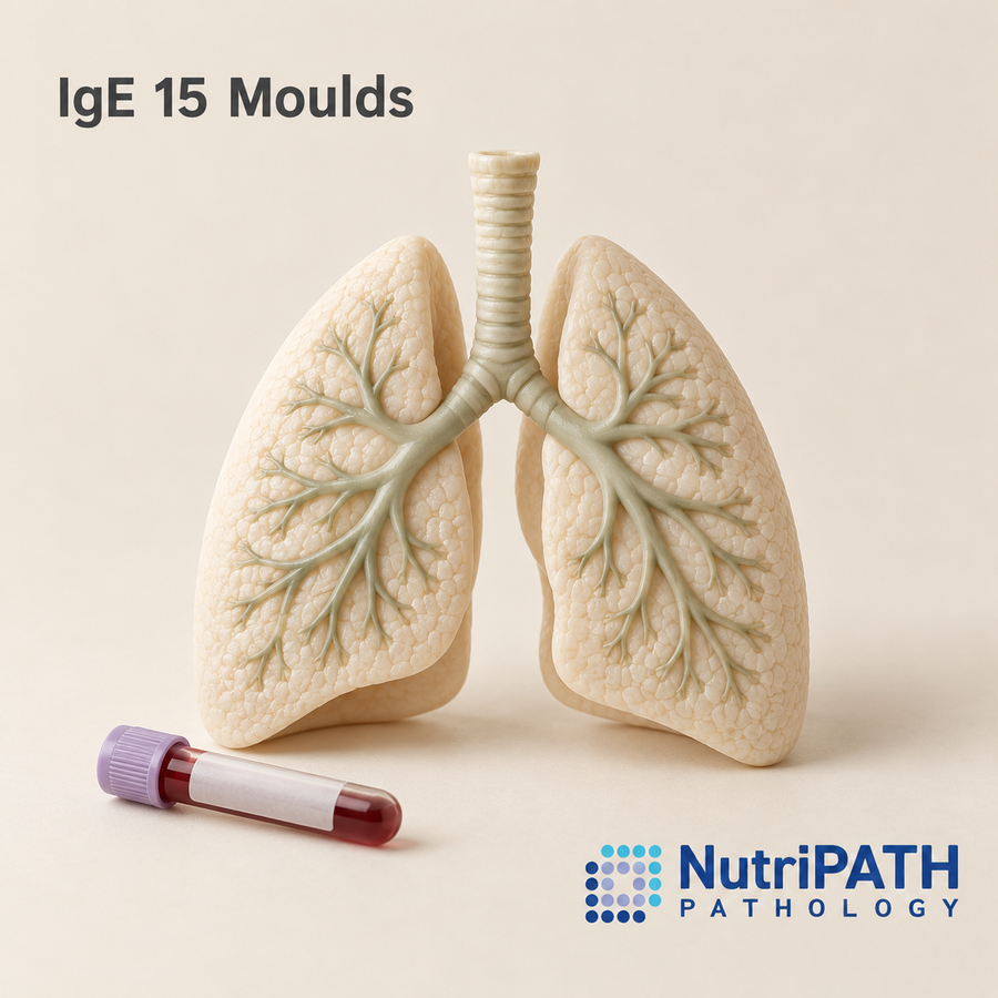 IgE 15 Moulds — original OptiLabs clinical illustration with supplier logo; collection items are illustrative, not the exact supplied kit