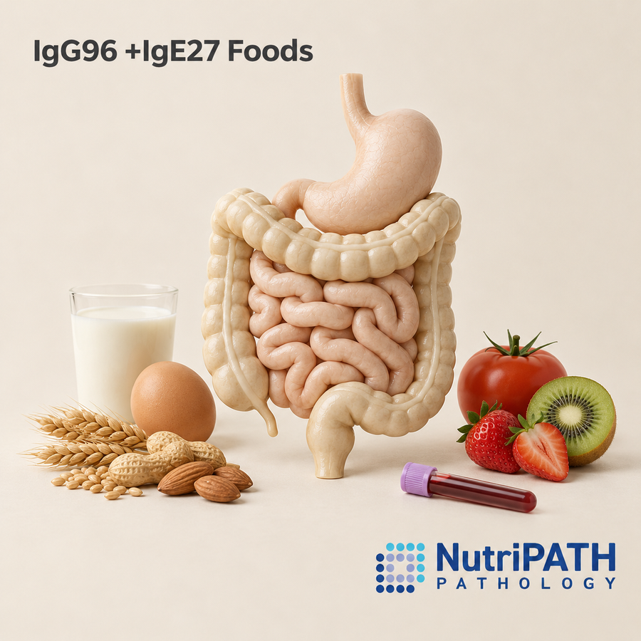 IgG96 +IgE27 Foods — original OptiLabs clinical illustration with supplier logo; collection items are illustrative, not the exact supplied kit