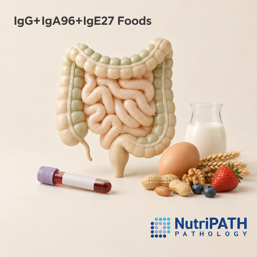 IgG+IgA96+IgE27 Foods — original OptiLabs clinical illustration with supplier logo; collection items are illustrative, not the exact supplied kit