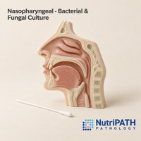 Nasopharyngeal - Bacterial & Fungal Culture — original OptiLabs clinical illustration with supplier logo; collection items are illustrative, not the exact supplied kit