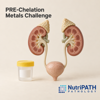 PRE-Chelation Metals Challenge — original OptiLabs clinical illustration with supplier logo; collection items are illustrative, not the exact supplied kit