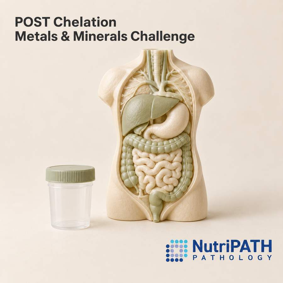 POST Chelation Metals & Minerals Challenge — original OptiLabs clinical illustration with supplier logo; collection items are illustrative, not the exact supplied kit