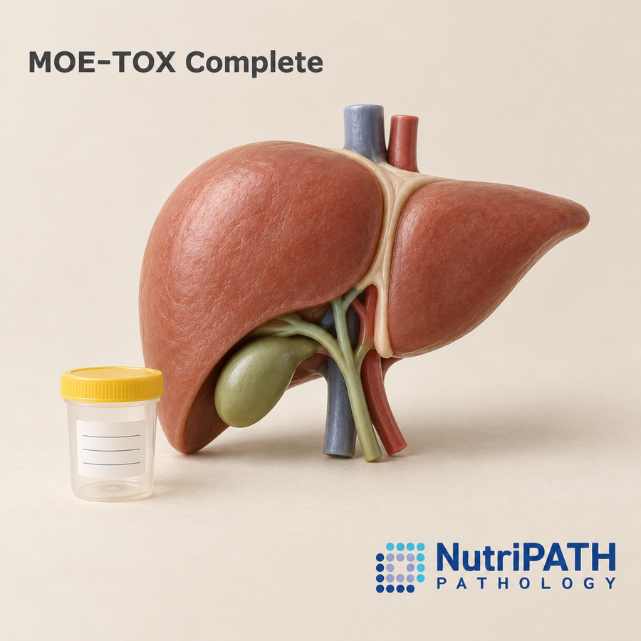 MOE-TOX Complete — original OptiLabs clinical illustration with supplier logo; collection items are illustrative, not the exact supplied kit