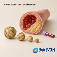 LIPOSCREEN LDL Subfractions — original OptiLabs clinical illustration with supplier logo; collection items are illustrative, not the exact supplied kit