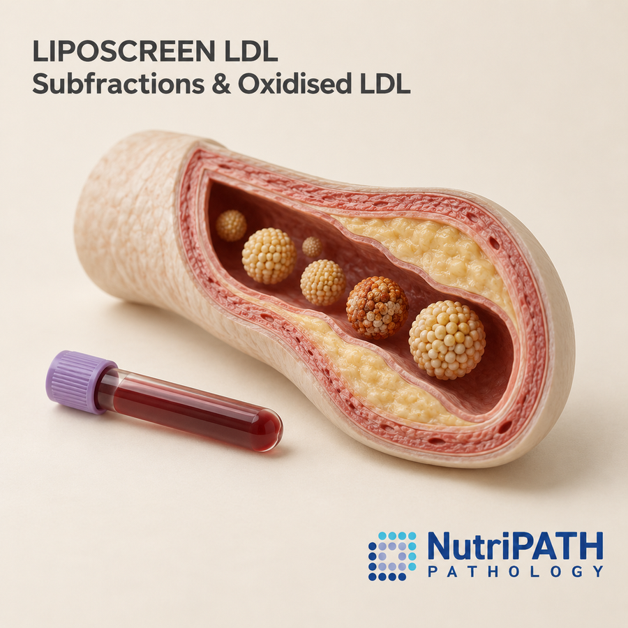 LIPOSCREEN LDL Subfractions & Oxidised LDL — original OptiLabs clinical illustration with supplier logo; collection items are illustrative, not the exact supplied kit