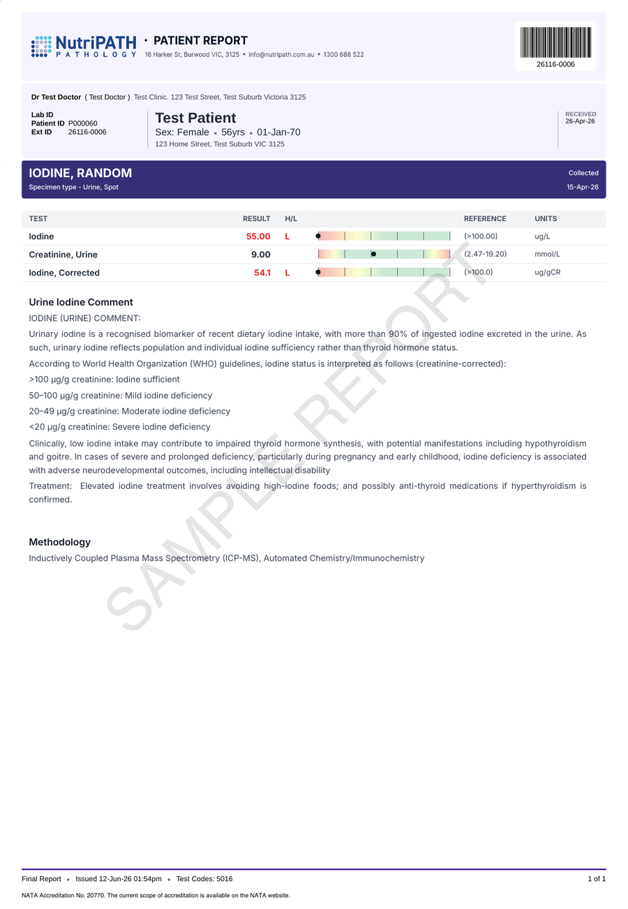 NutriPATH published sample report · Iodine - Random (urinary) · Example page 1; report format may vary