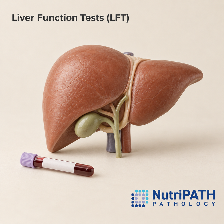 Liver Function Tests (LFT) — original OptiLabs clinical illustration with supplier logo; collection items are illustrative, not the exact supplied kit