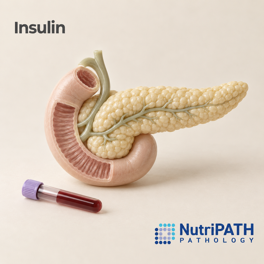 Insulin — original OptiLabs clinical illustration with supplier logo; collection items are illustrative, not the exact supplied kit