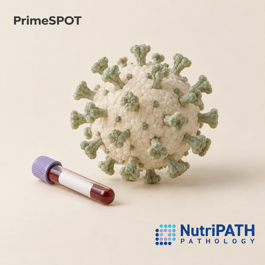 PrimeSPOT — original OptiLabs clinical illustration with supplier logo; collection items are illustrative, not the exact supplied kit