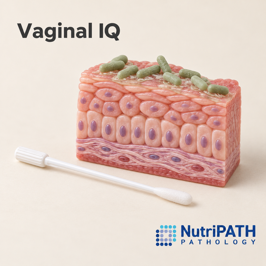 Vaginal IQ — original OptiLabs clinical illustration with supplier logo; collection items are illustrative, not the exact supplied kit