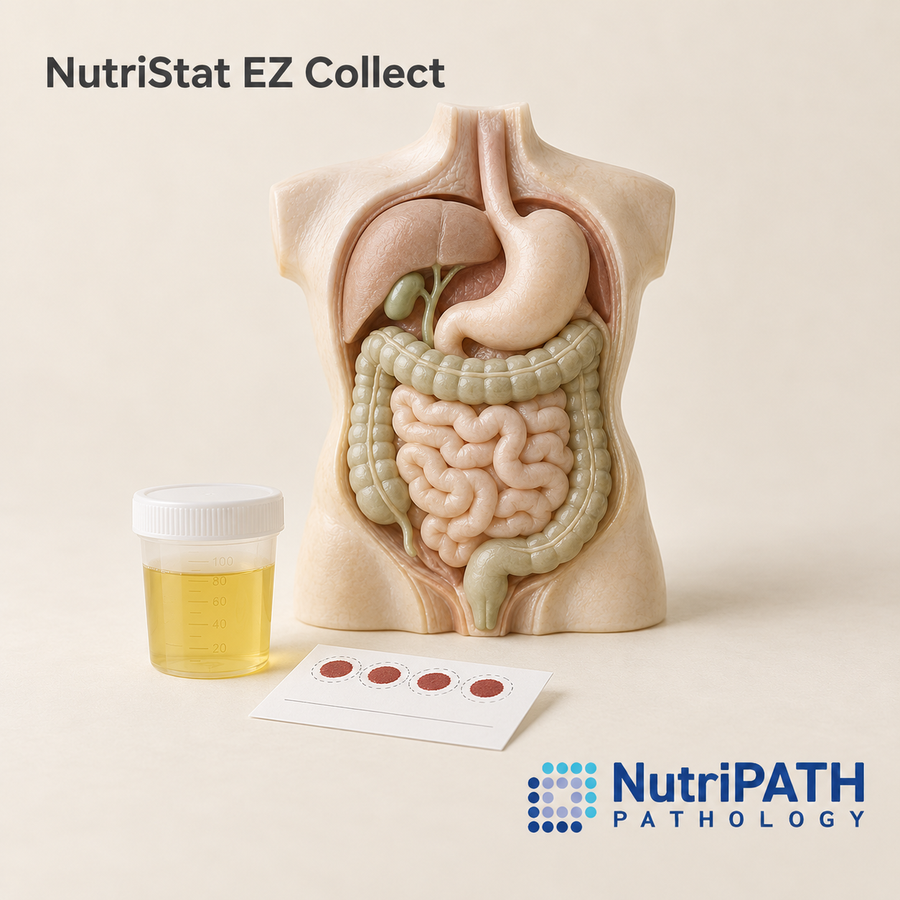 NutriStat EZ Collect — original OptiLabs clinical illustration with supplier logo; collection items are illustrative, not the exact supplied kit