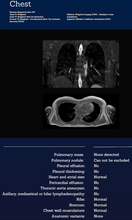 Load image into Gallery viewer, Whole Body MRI
