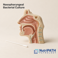Nasopharyngeal Bacterial Culture — original OptiLabs clinical illustration with supplier logo; collection items are illustrative, not the exact supplied kit