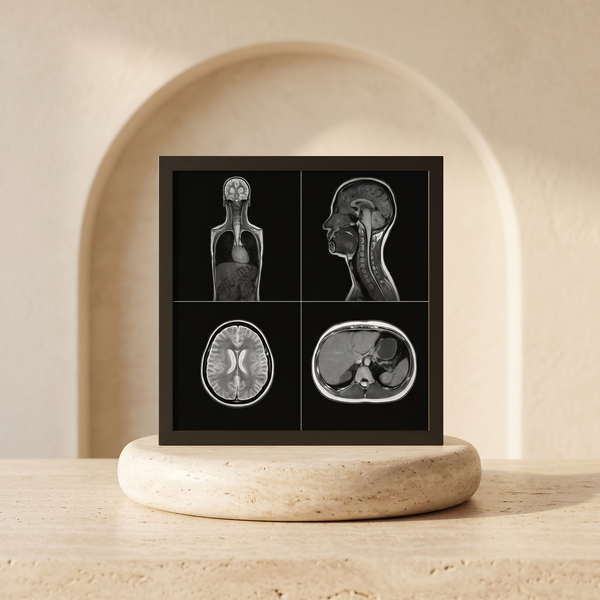 Whole body MRI screen