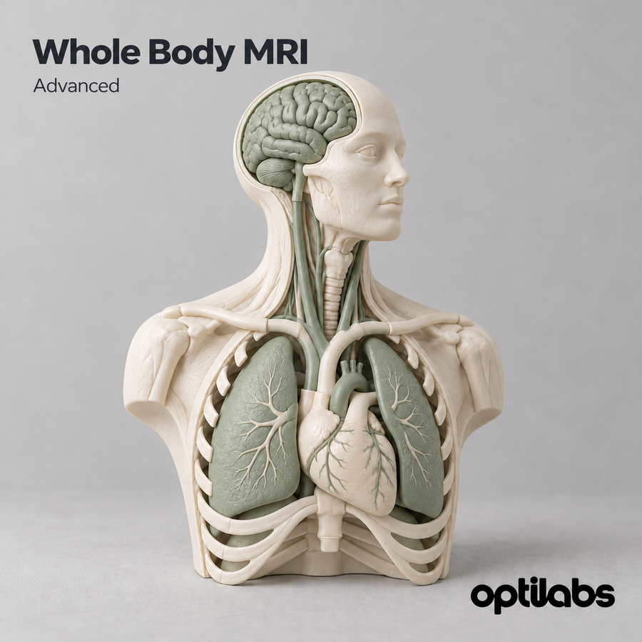 Whole Body MRI — original OptiLabs clinical illustration with supplier logo; collection items are illustrative, not the exact supplied kit